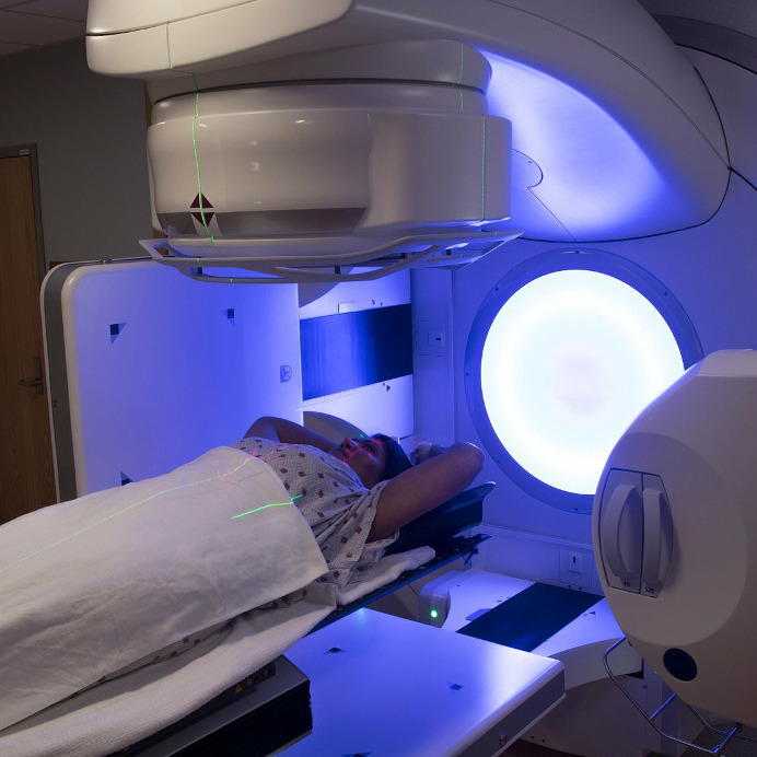 Reason #5 Cancer Still Sucks: Radiation Therapy is Hit or Miss