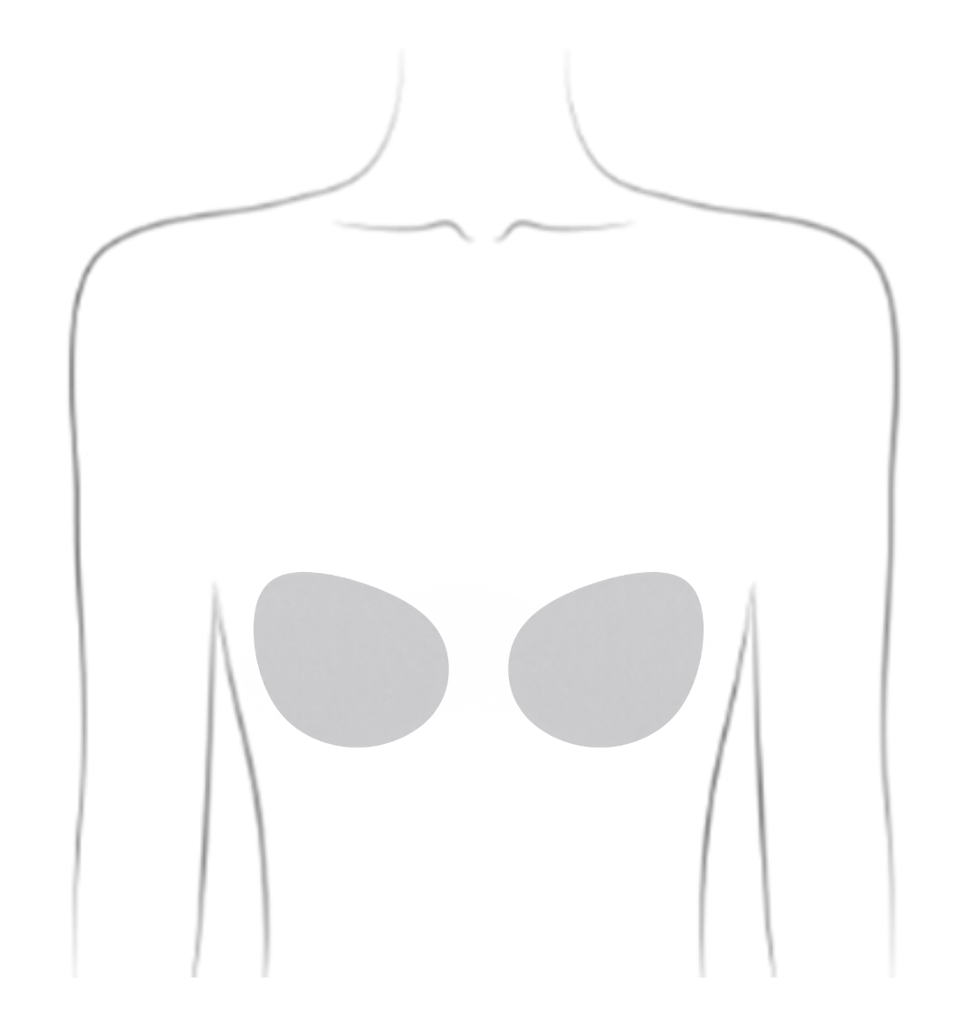 Mastectomy