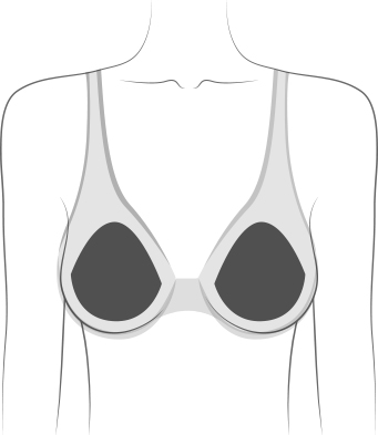 Breast Prosthetics, SurgeryGuide - Canadian Breast Cancer Network